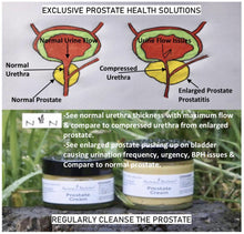 Load image into Gallery viewer, Natural Prostate Treatment Cream 15ml